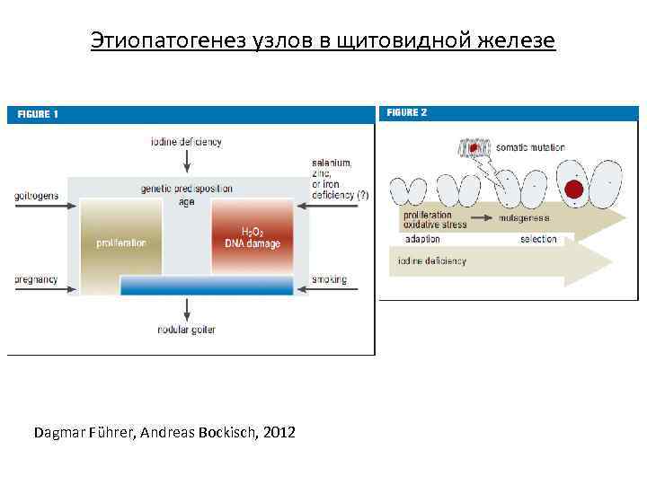 Этиопатогенез узлов в щитовидной железе Dagmar Führer, Andreas Bockisch, 2012 