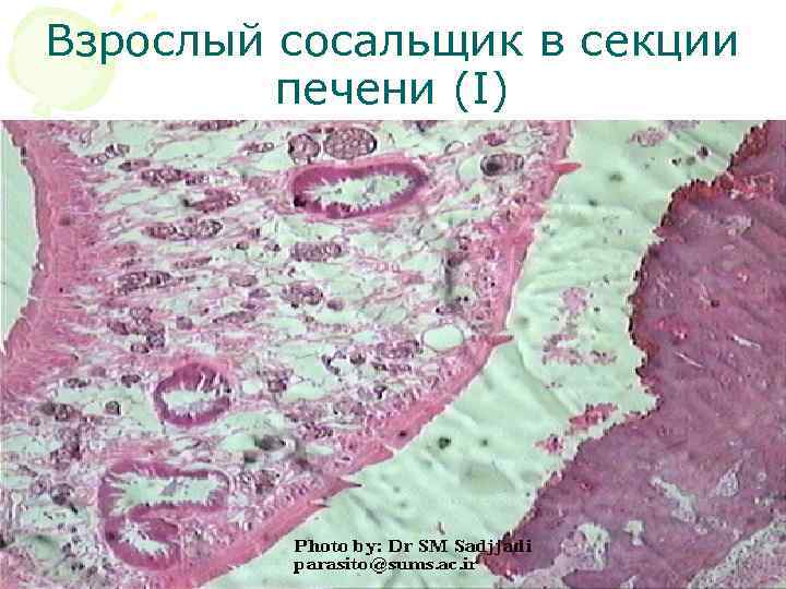 Взрослый сосальщик в секции печени (I) 