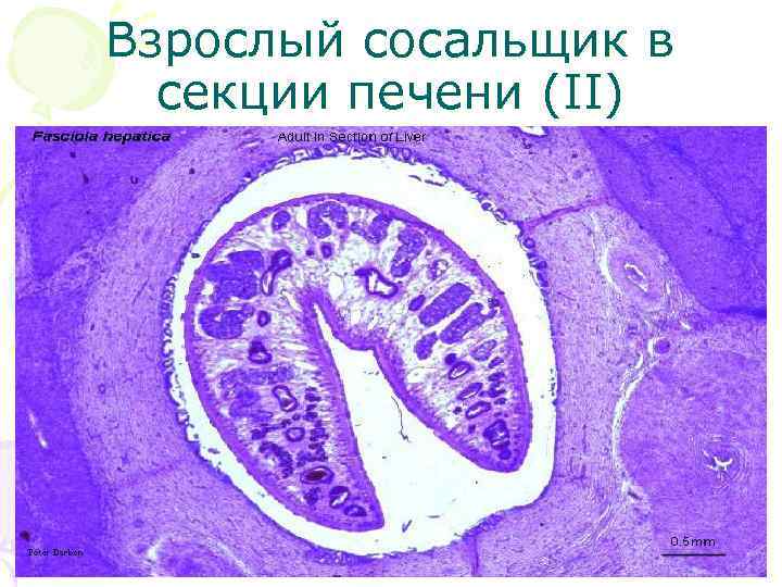 Взрослый сосальщик в секции печени (II) 