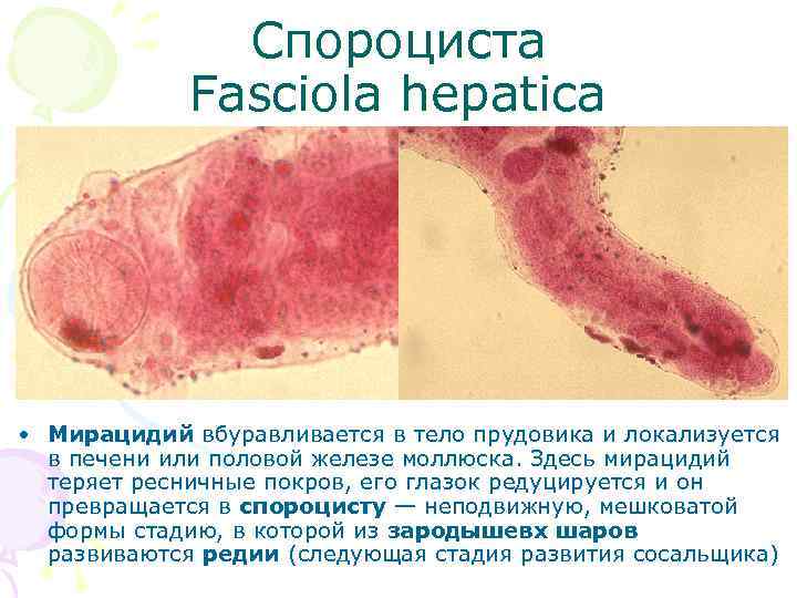 Спороциста Fasciola hepatica • Мирацидий вбуравливается в тело прудовика и локализуется в печени или