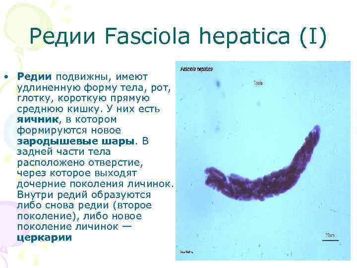 Редии Fasciola hepatica (I) • Редии подвижны, имеют удлиненную форму тела, рот, глотку, короткую