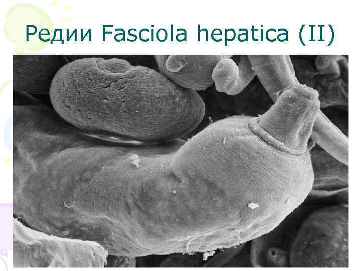 Редии Fasciola hepatica (II) 