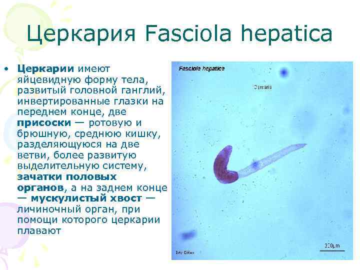Церкария Fasciola hepatica • Церкарии имеют яйцевидную форму тела, развитый головной ганглий, инвертированные глазки