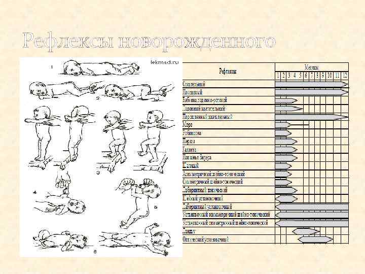 Рефлексы новорожденного 