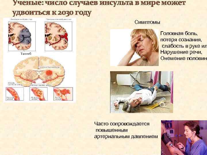 Ученые: число случаев инсульта в мире может удвоиться к 2030 году Симптомы Головная боль,