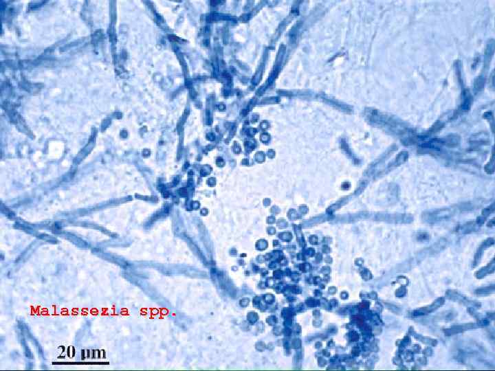 Malassezia spp. 