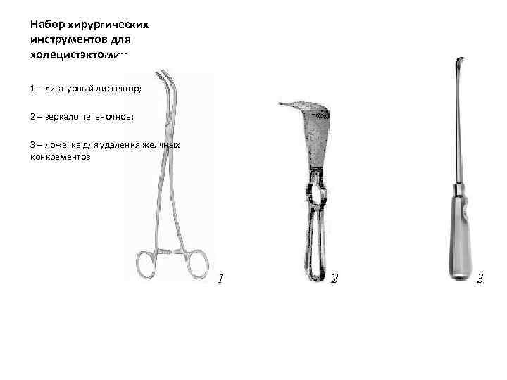 Набор хирургических инструментов для холецистэктомии 1 – лигатурный диссектор; 2 – зеркало печеночное; 3