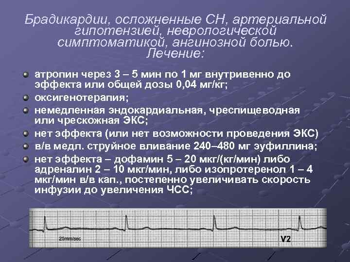 Брадикардии, осложненные СН, артериальной гипотензией, неврологической симптоматикой, ангинозной болью. Лечение: атропин через 3 –