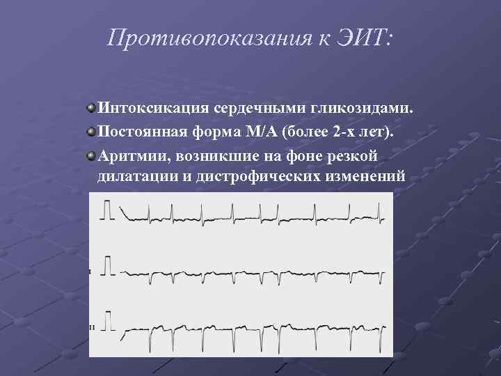 Противопоказания к ЭИТ: Интоксикация сердечными гликозидами. Постоянная форма М/А (более 2 -х лет). Аритмии,