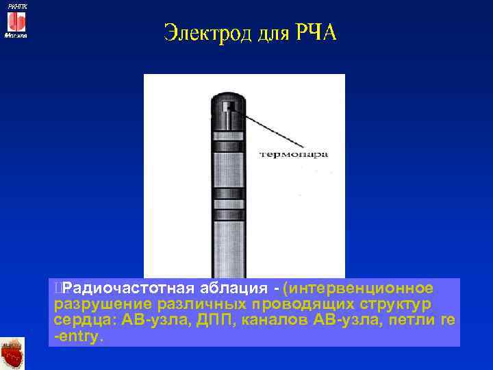 Ш Радиочастотная аблация - (интервенционное разрушение различных проводящих структур сердца: АВ-узла, ДПП, каналов АВ-узла,