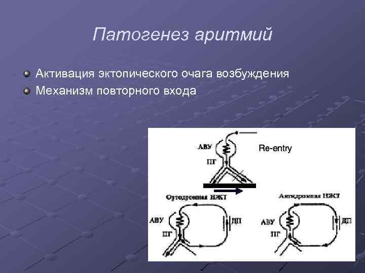 Патогенез аритмий Активация эктопического очага возбуждения Механизм повторного входа 