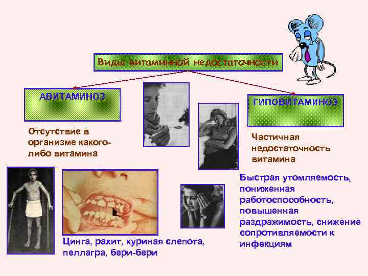 Виды витаминной недостаточности АВИТАМИНОЗ Отсутствие в организме какоголибо витамина Цинга, рахит, куриная слепота, пеллагра,