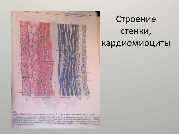 Строение стенки, кардиомиоциты 