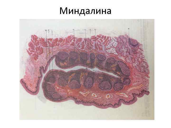 Миндалина 