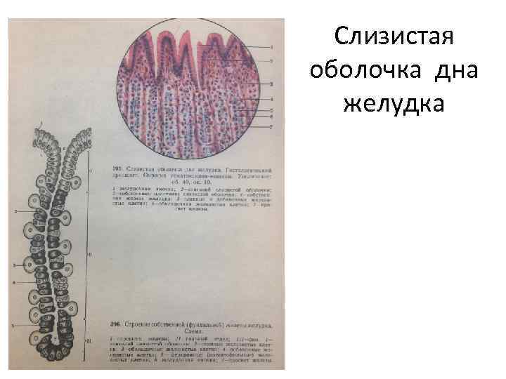 Слизистая оболочка дна желудка 