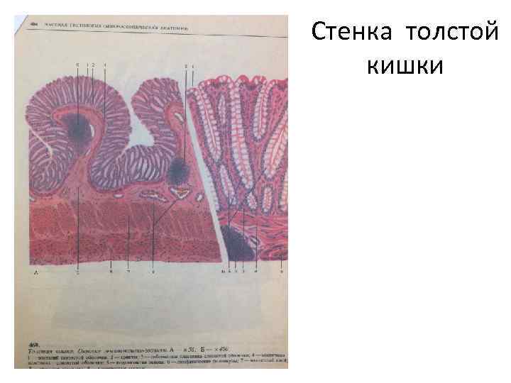 Стенка толстой кишки 