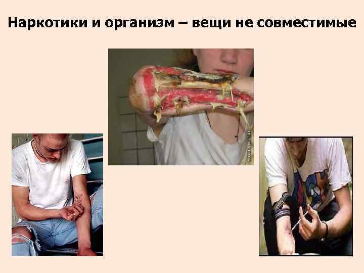 Наркотики и организм – вещи не совместимые 