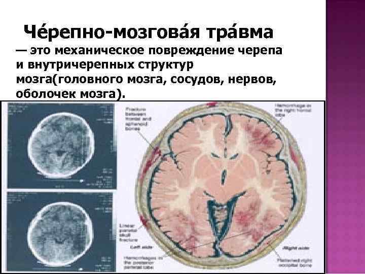 Что такое механическое повреждение ноутбука