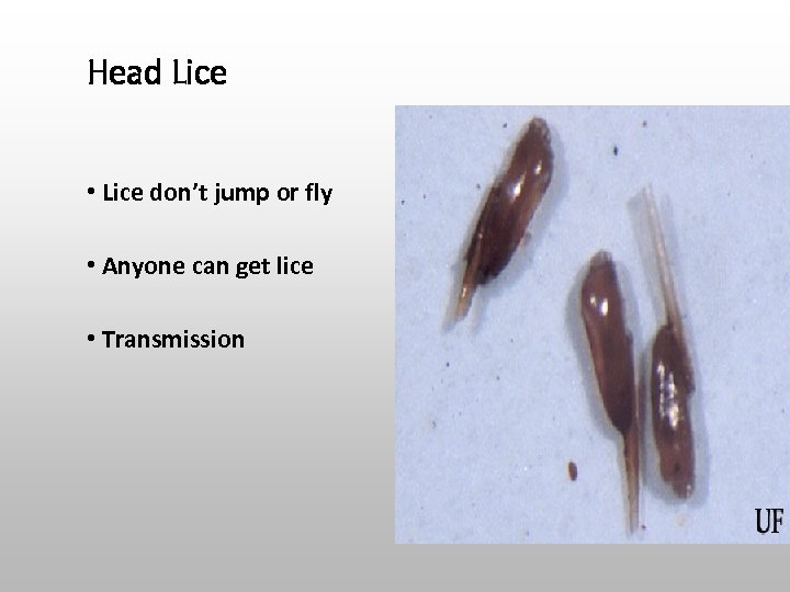 Head Lice • Lice don’t jump or fly • Anyone can get lice •