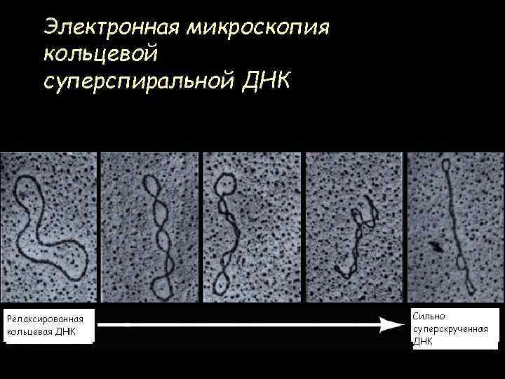 Электронная микроскопия кольцевой суперспиральной ДНК 