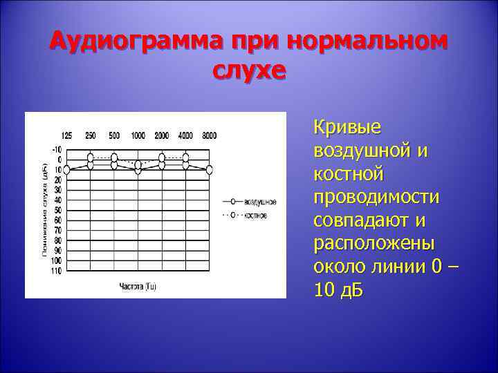 Аудиограмма слуха что это