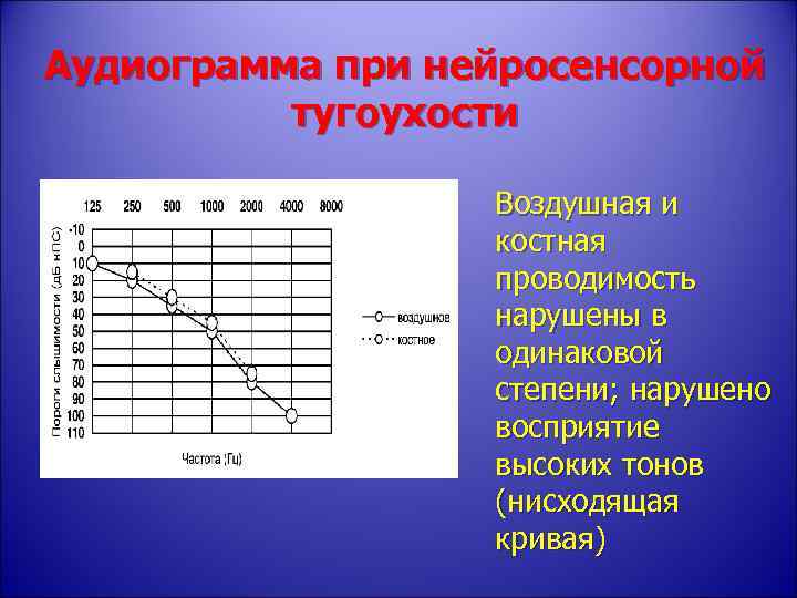 Аудиограмма это