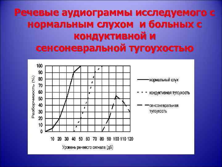 Речевые аудиограммы исследуемого с нормальным слухом и больных с кондуктивной и сенсоневральной тугоухостью 