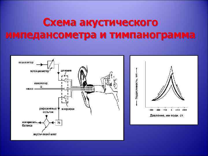 Схема акустического импедансометра и тимпанограмма 