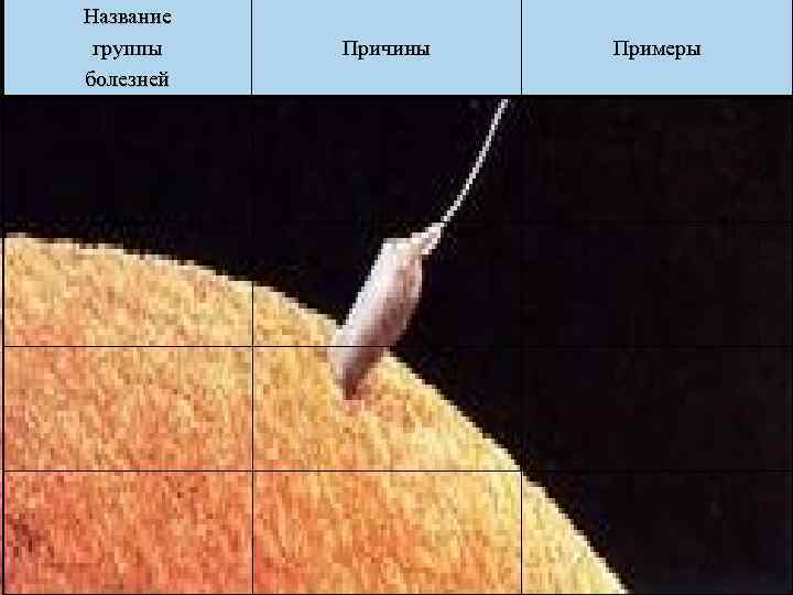 Название группы болезней Причины Примеры 