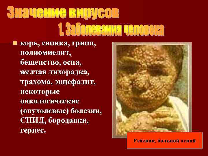 n корь, свинка, грипп, полиомиелит, бешенство, оспа, желтая лихорадка, трахома, энцефалит, некоторые онкологические (опухолевые)