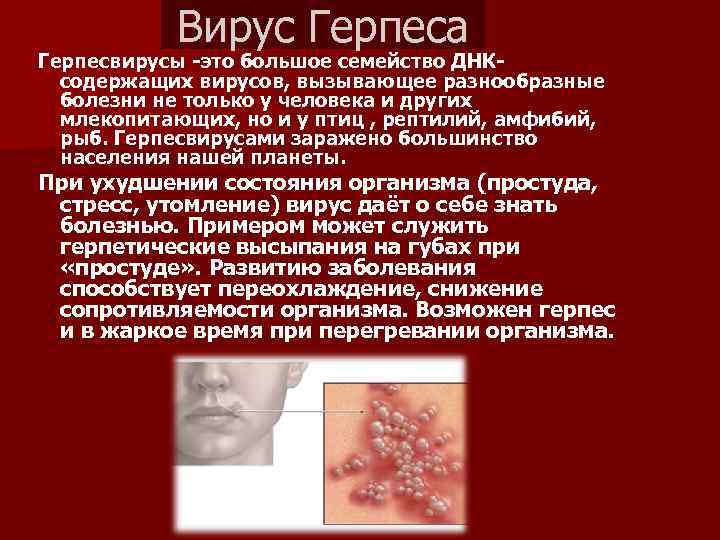 Вирус Герпеса Герпесвирусы -это большое семейство ДНКсодержащих вирусов, вызывающее разнообразные болезни не только у