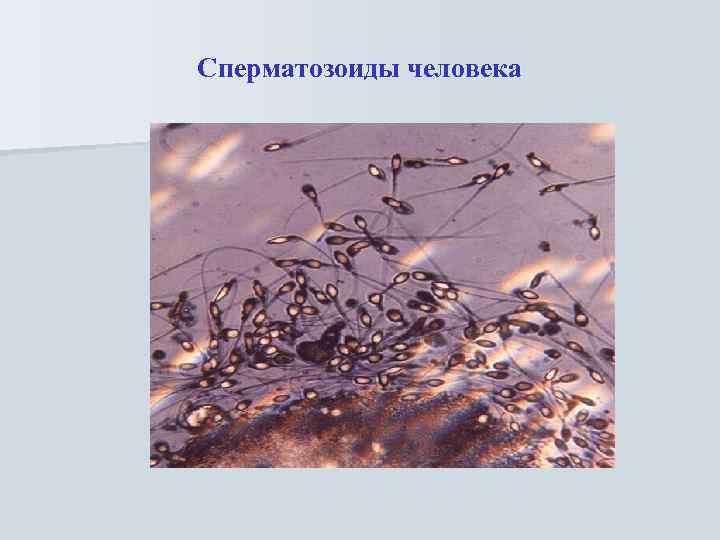 Сперматозоиды человека 
