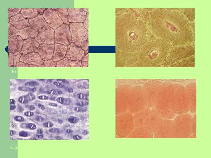Клетки однослойного эпителия Клетки хрящевой ткани Клетки костной ткани Клетки жировой ткани 