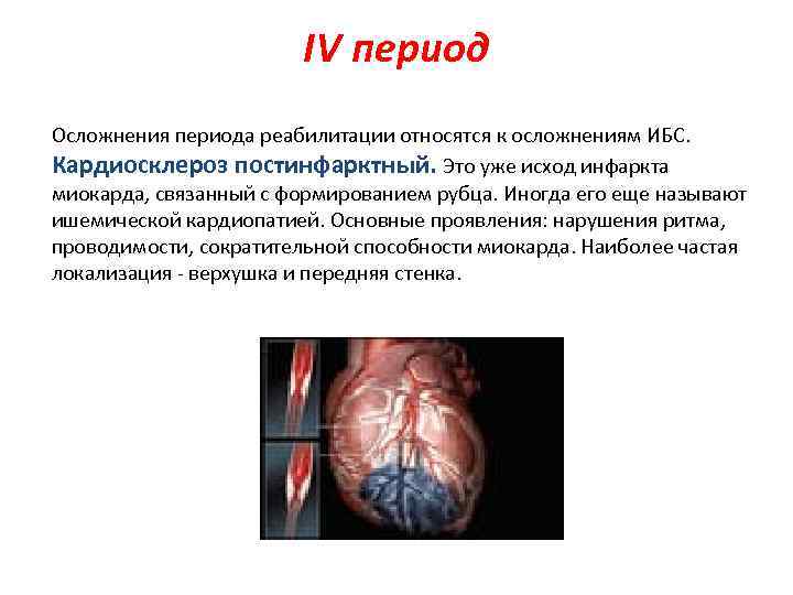 IV период Осложнения периода реабилитации относятся к осложнениям ИБС. Кардиосклероз постинфарктный. Это уже исход