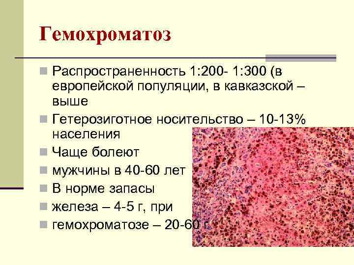 Гемохроматоз n Распространенность 1: 200 - 1: 300 (в европейской популяции, в кавказской –