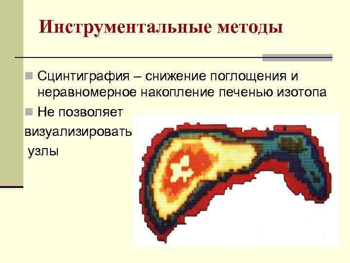 Инструментальные методы n Сцинтиграфия – снижение поглощения и неравномерное накопление печенью изотопа n Не
