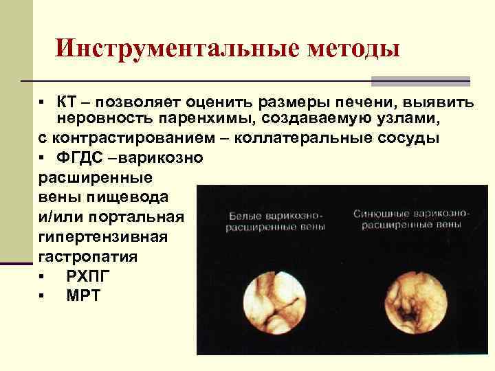 Инструментальные методы § КТ – позволяет оценить размеры печени, выявить неровность паренхимы, создаваемую узлами,