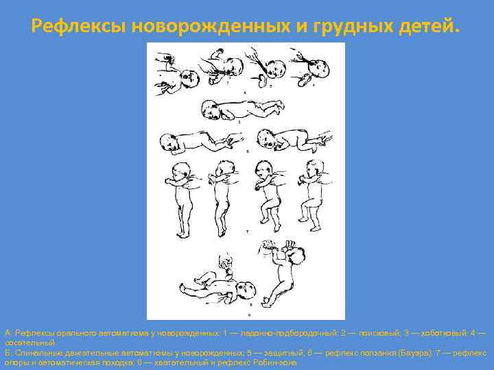 Рефлексы новорожденных и грудных детей. А. Рефлексы орального автоматизма у новорожденных: 1 — ладонно