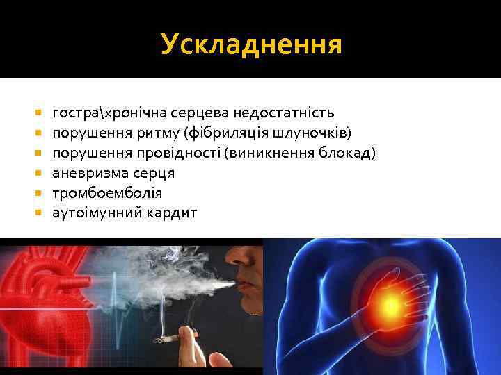 Ускладнення гострахронічна серцева недостатність порушення ритму (фібриляція шлуночків) порушення провідності (виникнення блокад) аневризма серця