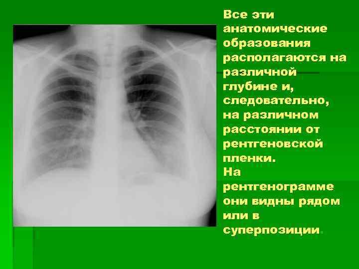 Все эти анатомические образования располагаются на различной глубине и, следовательно, на различном расстоянии от