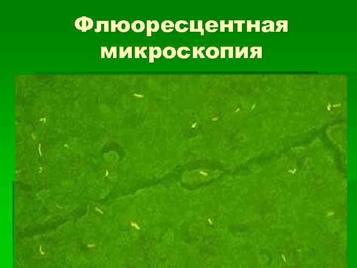 Флюоресцентная микроскопия 