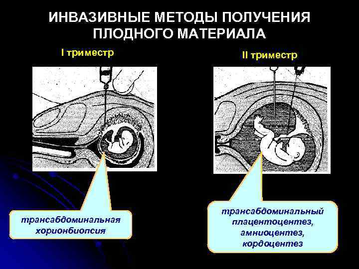 ИНВАЗИВНЫЕ МЕТОДЫ ПОЛУЧЕНИЯ ПЛОДНОГО МАТЕРИАЛА I триместр трансабдоминальная хорионбиопсия II триместр трансабдоминальный плацентоцентез, амниоцентез,