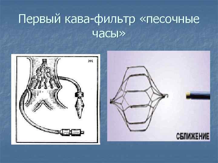 Первый кава-фильтр «песочные часы» 
