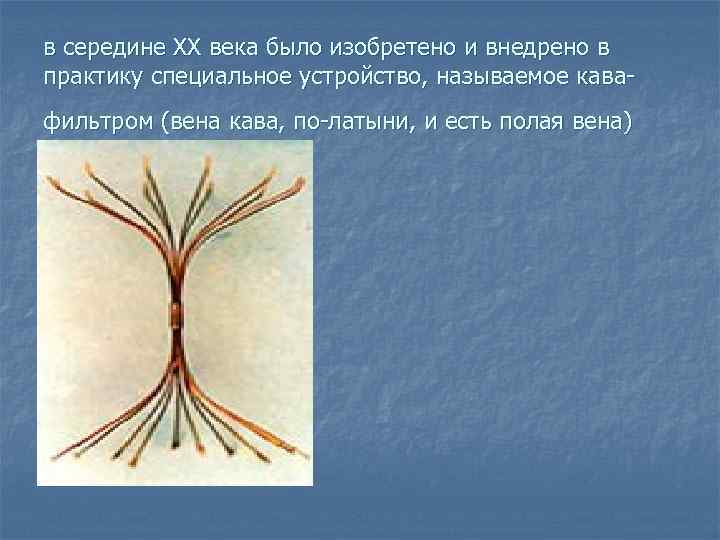 в середине ХХ века было изобретено и внедрено в практику специальное устройство, называемое кава-