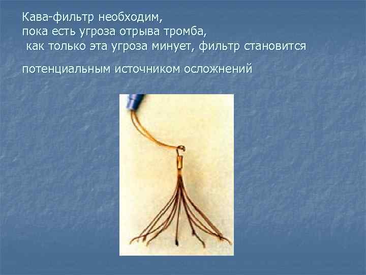 Кава-фильтр необходим, пока есть угроза отрыва тромба, как только эта угроза минует, фильтр становится