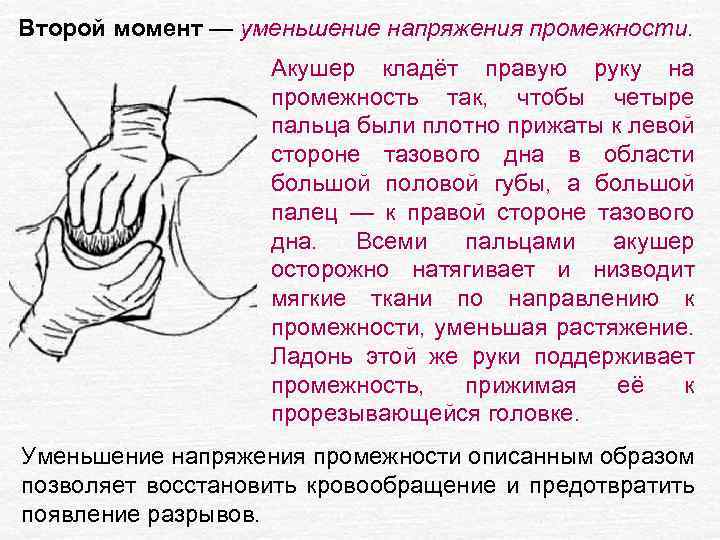 Второй момент — уменьшение напряжения промежности. Акушер кладёт правую руку на промежность так, чтобы
