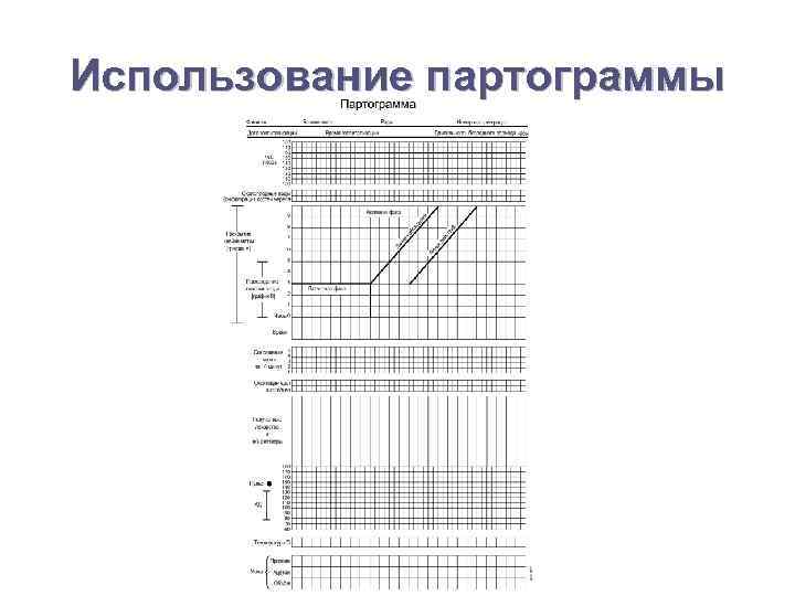 Партограмма в акушерстве как заполнять образец заполнения