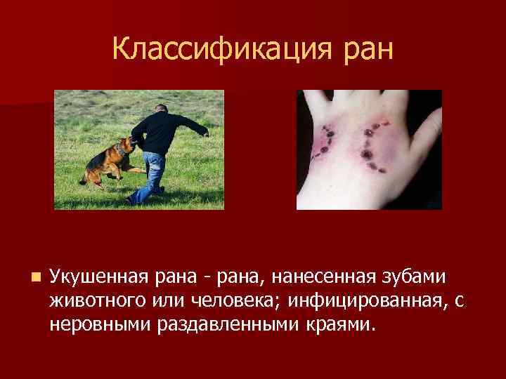 Классификация ран n Укушенная рана - рана, нанесенная зубами животного или человека; инфицированная, с