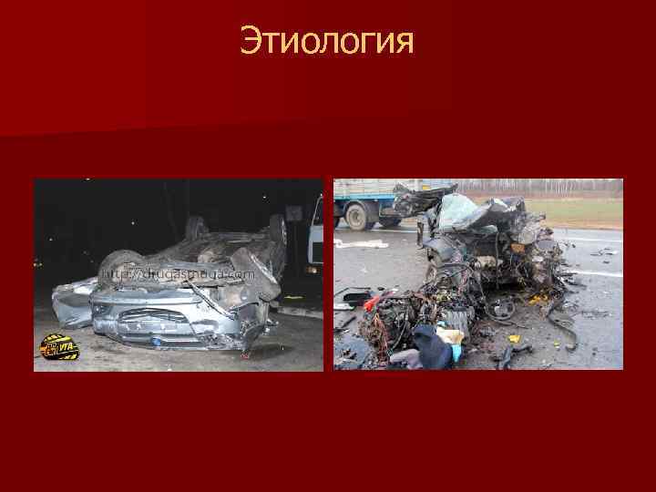 Этиология 