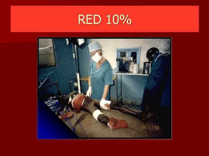 RED 10% 